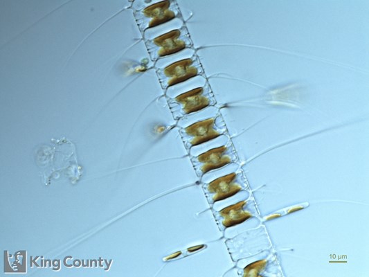 Photo of Chaetoceros diadema